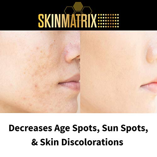 מתקן כתם כהה-קרם התבהרות עור באופן טבעי נמוג כתמים וסימנים עבור פנים & מגבר; גוף. תיקוני גוון עור לא אחיד &