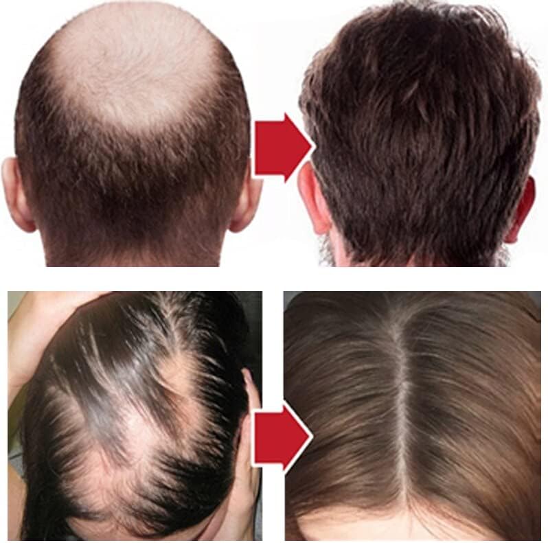 מותסס אורז שיער לצמיחה מחודשת סרום אנטי שיער אובדן חיוני שמן צמיחת קו שיער נוזל תיקון פגום שערות להזין שורשי יופי